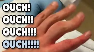 Doctor...pull my finger!  Dislocated Finger!