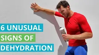 6 Unusual Signs of Dehydration You Should Know About