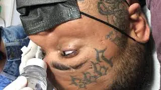 TATUAGEM NO OLHO EYEBALL TATTOO BY FREAK UREA