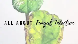 All About Fungal Infection