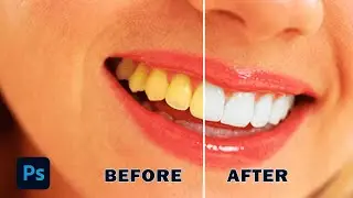 Whiten teeth under 1 minute in Photoshop. No Clickbait