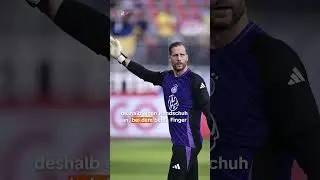 Ist euch Baumanns spezieller Handschuh auch schon aufgefallen? | sportstudio | 