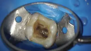 Reciproc Blue