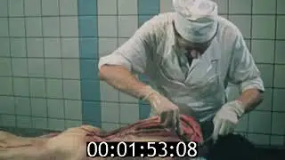 Повешенный(16+) Судебно  медицинская экспертиза механической асфиксии (1990) для студентов медвузов