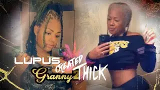 Tyler AKA Granny 2 Thick - Lupus Symptoms Created The Granny 2 Thick Character (Part 1)