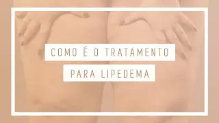 Como é o Tratamento Para Lipedema? | Cirurgia Plástica | Dr Leandro Gontijo