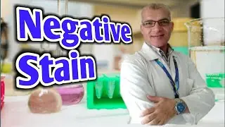 Bacterial Negative Stain Procedure