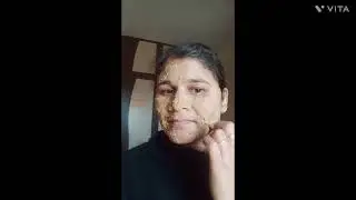 Day_2 glowing skin challenge 🤗💫🤔 #झाइयां कम हो गई 😱 पिंपल गायब #skincare #viral remedy