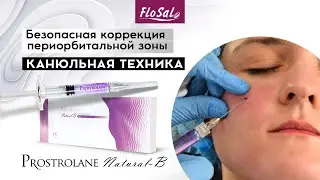 Безопасная коррекция периорбитальной зоны: техника канюли препаратом Prostrolane Natural-B
