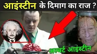 Who Stole Albert Einstein's Brain After Death/brain intelligent/Brain work/