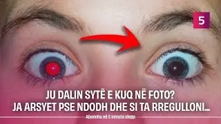 Ju dalin sytë e kuq në foto, ja arsyet pse ndodh dhe si ta rregulloni...