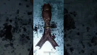 Колечко в трахее 