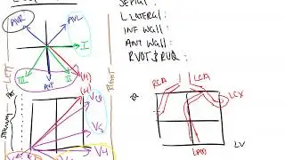 ECG Part II