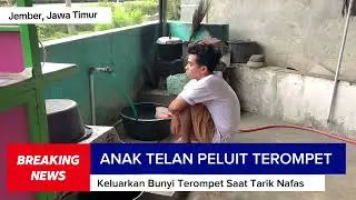 MIRIS!! ANAK TELAN PELUIT TEROMPET