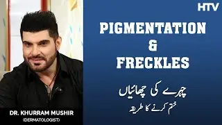 Pigmentation and Freckles Treatment by Dr. Khurram Mushir | Clinic Online | HTV