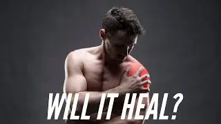 Let's talk about your ROTATOR CUFF. Will it HEAL?