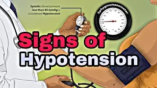 Signs of Hypotension|University Examination|Knowledge Madnoob