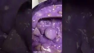 Kalami ba. unsa ni benignit? 
