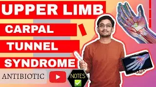 CARPAL TUNNEL SYNDROME DETAIL EXPLANATION WITH UNIVERSITY NOTES📔📔