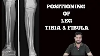 HOW TO DO X-RAY OF LEG. X-RAY TIBIA & FIBULA #anatomy #leg #xrayclasses