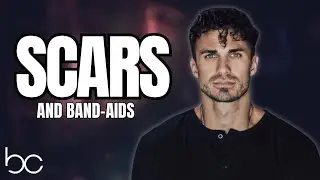Scars and Bandaids / E2 Church Edition