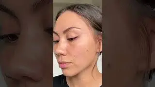 Do you struggle with redness?