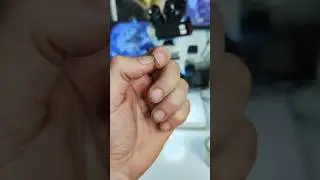 ПОД НОГТЯМИ ГЛИСТЫ ПОД МИКРОСКОПОМ
