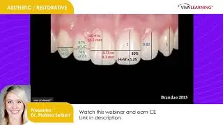 Viva Learning Clinical Tip: Anterior Composite Artistry
