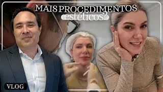 Vlogão - Rotina, harmonização facial