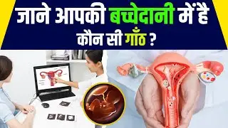 Uterine Fibroids :- Types, Causes, Risk Factors, Signs & Symptoms, Diagnosis & Treatment