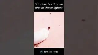 Get a Little Closer with a Dermlite!