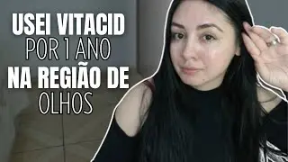 USEI VITACID NA REGIÃO DE OLHOS POR 1 ANO | minha combinação PERFEITA para HIDRATAR