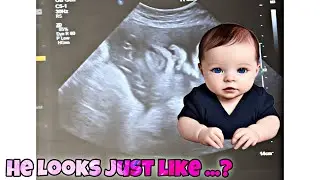 WE SAW OUR BABY’S FACE FOR THE FIRST TIME!🥰😍