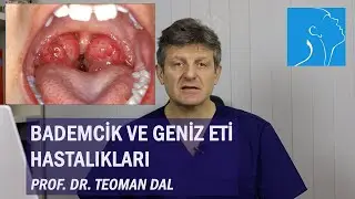 BADEMCİK VE GENİZ ETİ HASTALIKLARI | PROF. DR. TEOMAN DAL