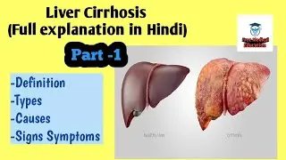 Liver Cirrhosis full explanation in Hindi(Definition,Types, Causes, Signs Symptoms)
