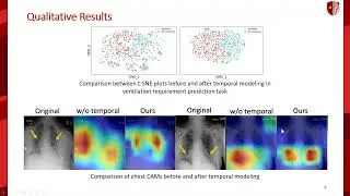 Temporal Context Matters: Enhancing Single Image Prediction With Disease Progression | CVPR 2022