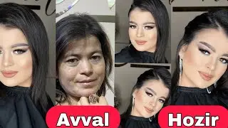 Lalito avjida-ku!
