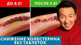 HOW TO REDUCE CHOLESTEROL WITHOUT PILLS? It's possible! // 