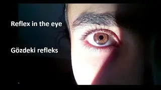 reflex in the eye --- Gözdeki refleks