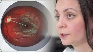 ELIKSIR - Pregledi vida kod dece i rehabilitacija vida  - dr Aleksandra Andrejevna Vidrina