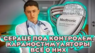 Как работает кардиостимулятор? Разбор кардиолога.