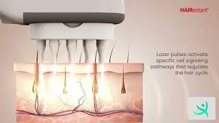Unlock Hair Growth Potential: With HAIRestart!