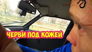 Черви под кожей. 1 часть.