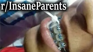 Mom Ziptied My Mouth Shut | r/InsaneParents