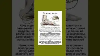 Как справиться с пяточными шпорами 