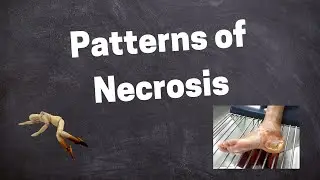 Morphology of Necrosis