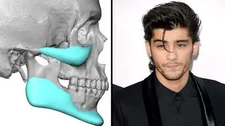 How to get a beautiful jawline(mewing)