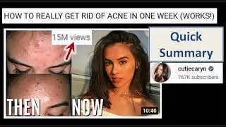 How to really get rid of acne in one week (Works!) - Quick Summary