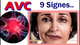 AVC : 9 SIGNES et SYMPTÔMES | Reconnaître un Accident Vasculaire Cérébral VITE !
