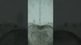 ИСКУССТВЕННОЕ ОПЛОДОТВОРЕНИЕ ПОД МИКРОСКОПОМ